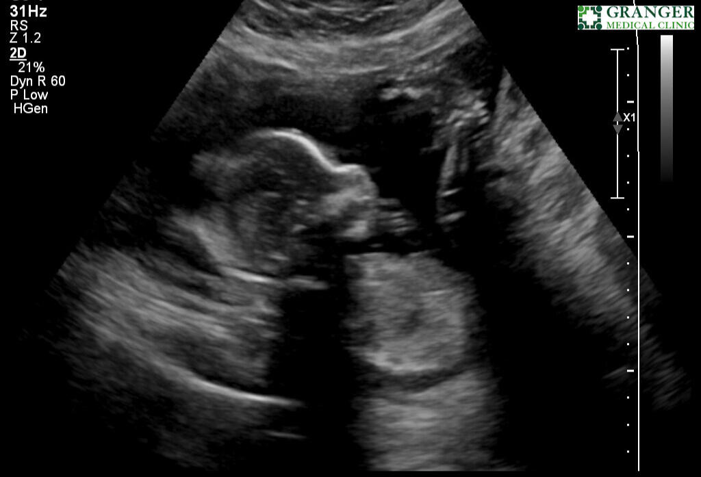 Ultrasound March 24