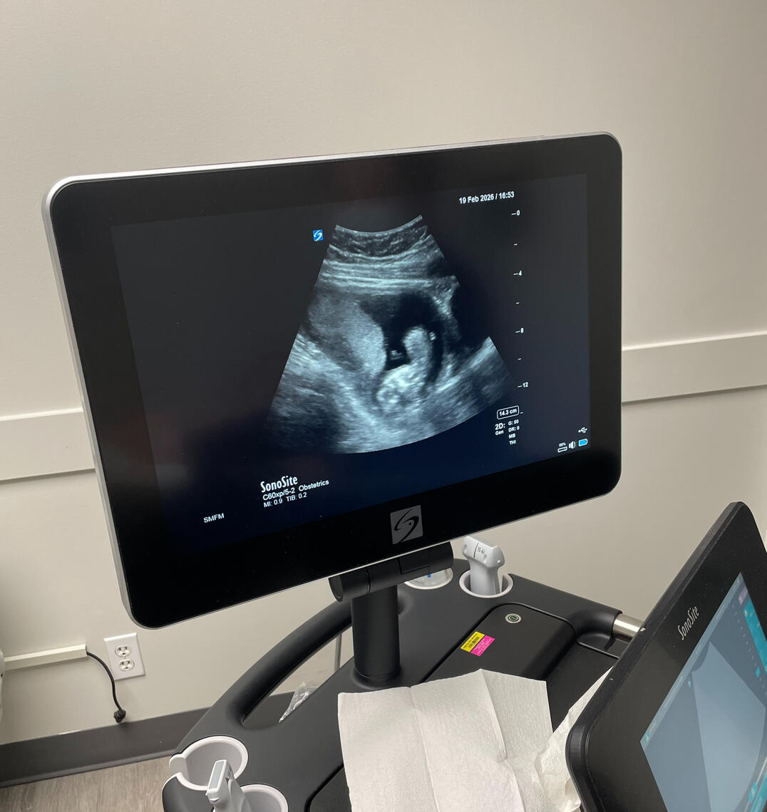 Ultra sound Feb 10th